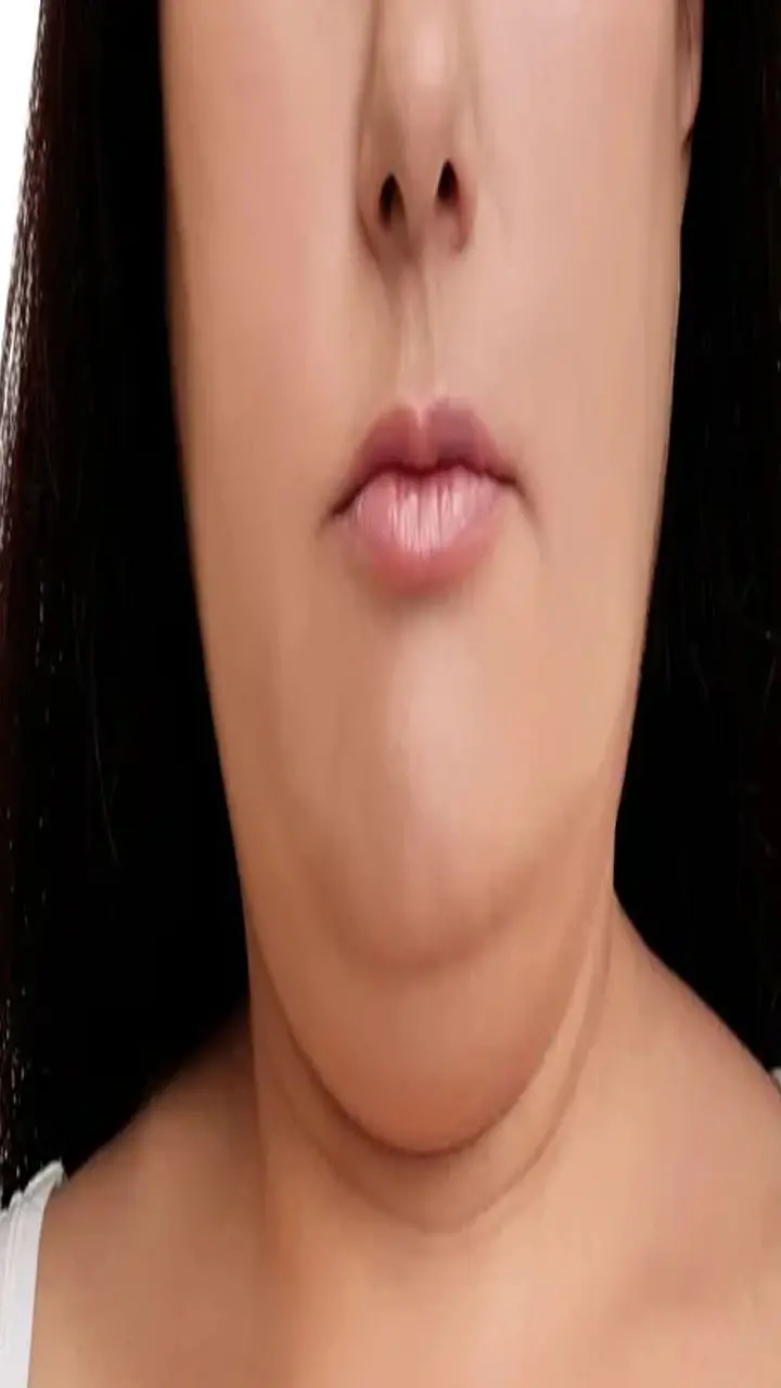 Double chin kaise kam kare: डबल चिन कैसे कम करें, ये सिंपल तरीके आएंगे काम