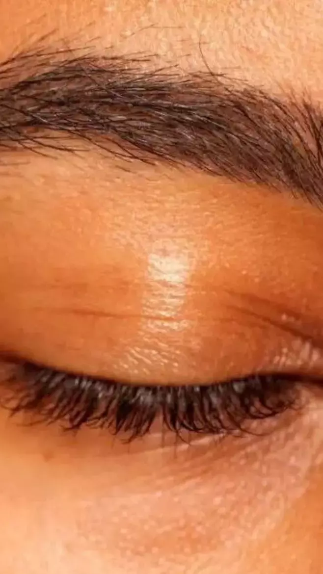 Kidney Kharab Hone Ke Lakshan: किडनी में खराबी होने के क्या है लक्षण, ये संकेत आएं तो...