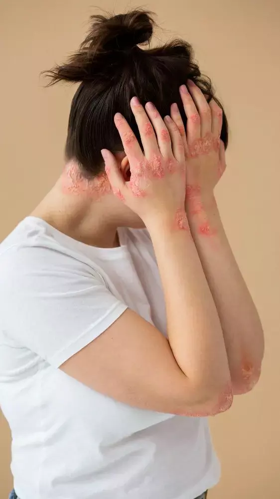 Neem Leaves Health Benefits: एक नहीं कई समस्याओं का इलाज है नीम की पत्तियां, जाने लें आप भी