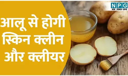डार्क सर्कल से लेकर झुर्रियों तक, सिर्फ एक आलू से होगी स्किन क्लीन और क्लीयर