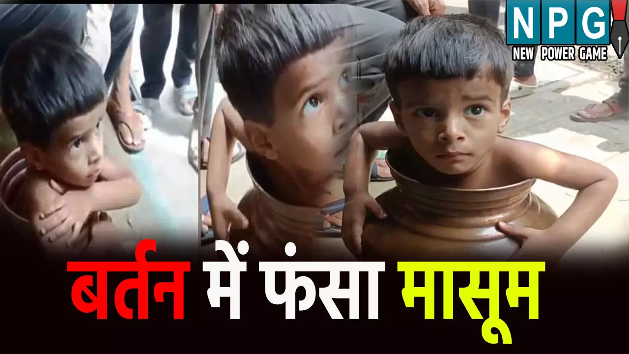 खेलते-खेलते बर्तन में फंसा मासूम, सोशल मीडिया में VIDEO हुआ वायरल