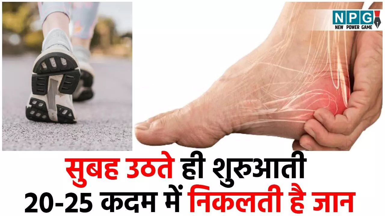 Home Remedies For Heel Pain: सुबह उठते ही शुरुआती 20-25 कदम चलने में निकलती है जान? ये सरल घरेलू नुस्खे करेंगे मदद...