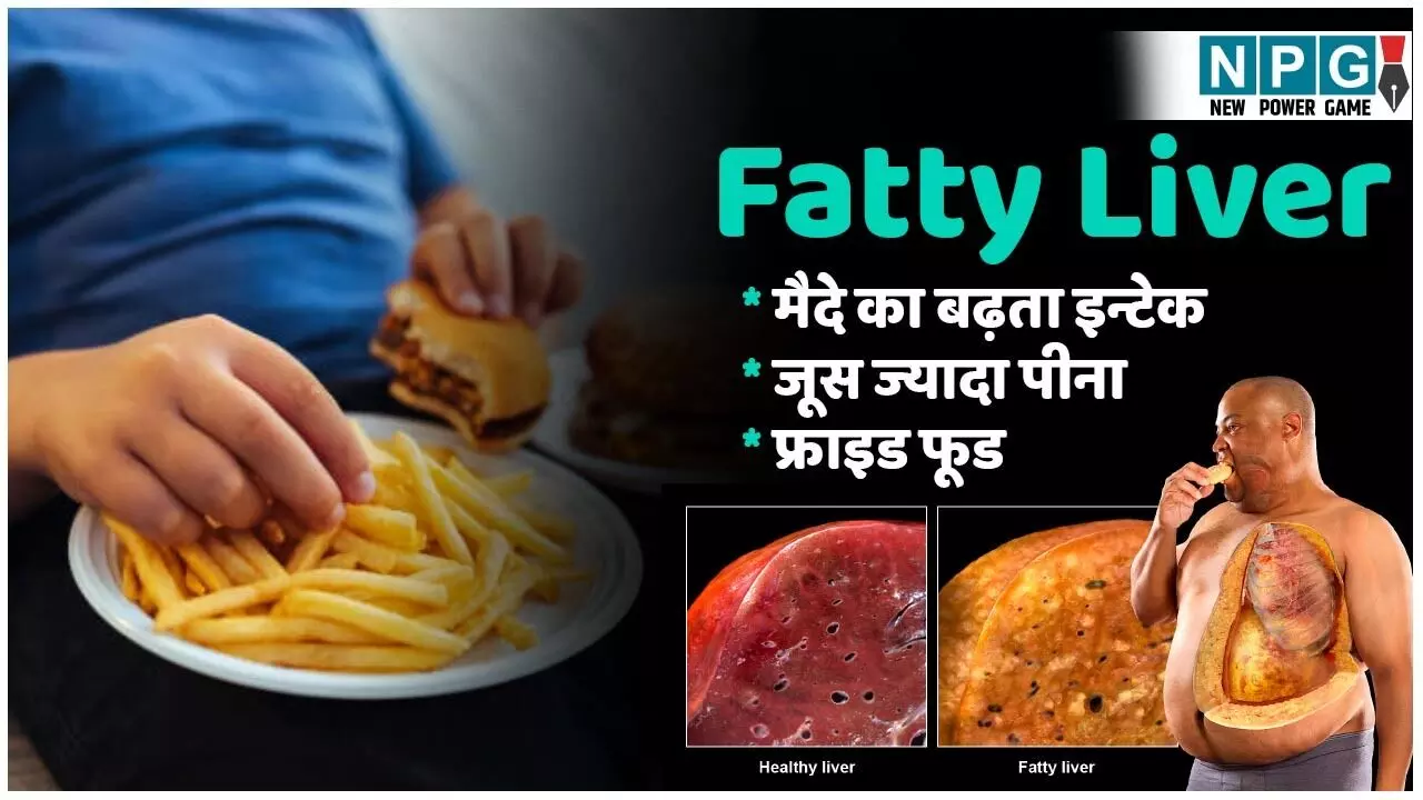 Fatty Liver Kya Hai: अब तो बच्चे में भी बढ़ने लगे फैटी लिवर के मामले, जानिए कहां हो रही है मिस्टेक