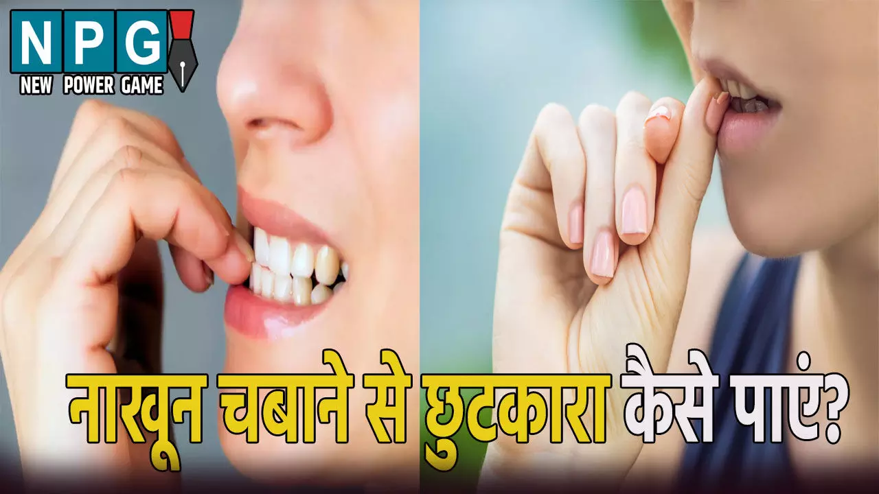 अगर आप भी चबाते हैं नाखून, तो हो जाएं सावधान! इन बीमारियों का रहता है खतरा, ऐसे पाएं छुटकारा अगर आप भी चबाते हैं नाखून, तो हो जाएं सावधान! इन बीमारियों का रहता है खतरा, ऐसे पाएं छुटकारा