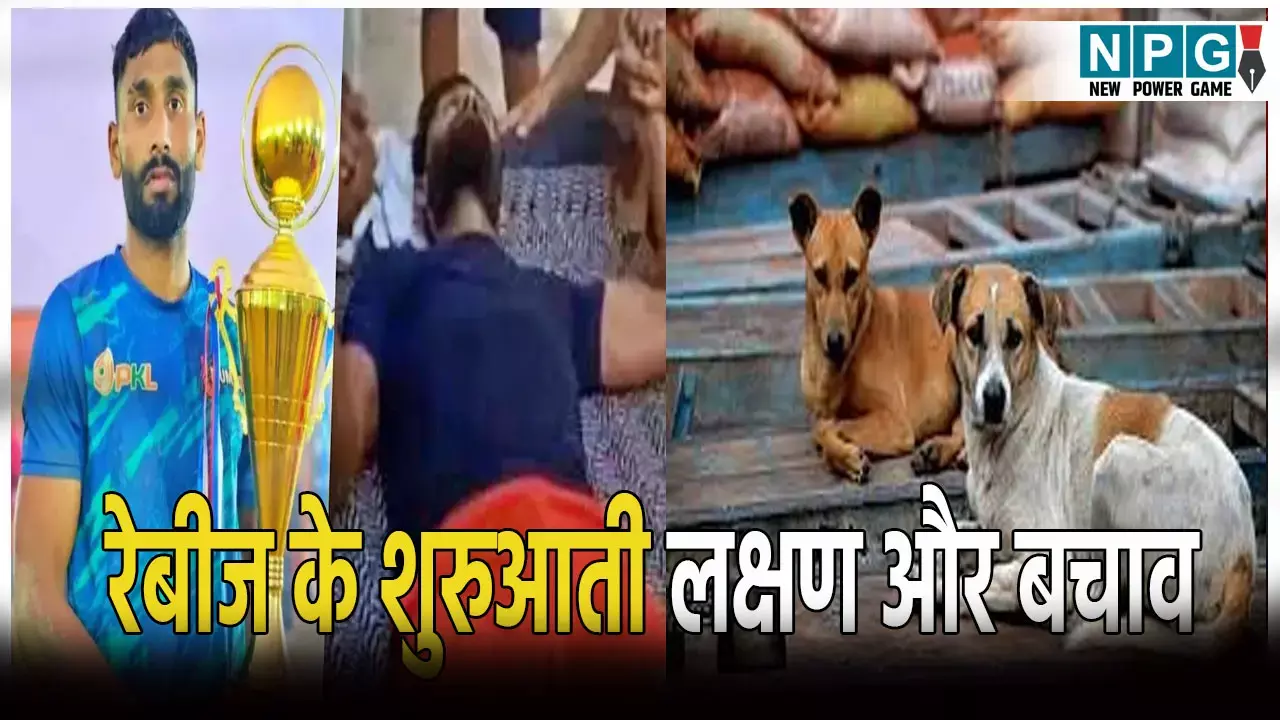 कुत्ते के काटने से कबड्डी प्लेयर की मौत...जानिए क्या होते हैं रेबीज के शुरुआती लक्षण और कैसे करें बचाव