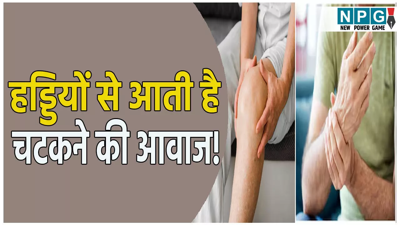 अगर हड्डियों से आती है चटकने की आवाज! तो भूलकर भी न करें नजरअंदाज, हो सकती है ये गंभीर समस्या