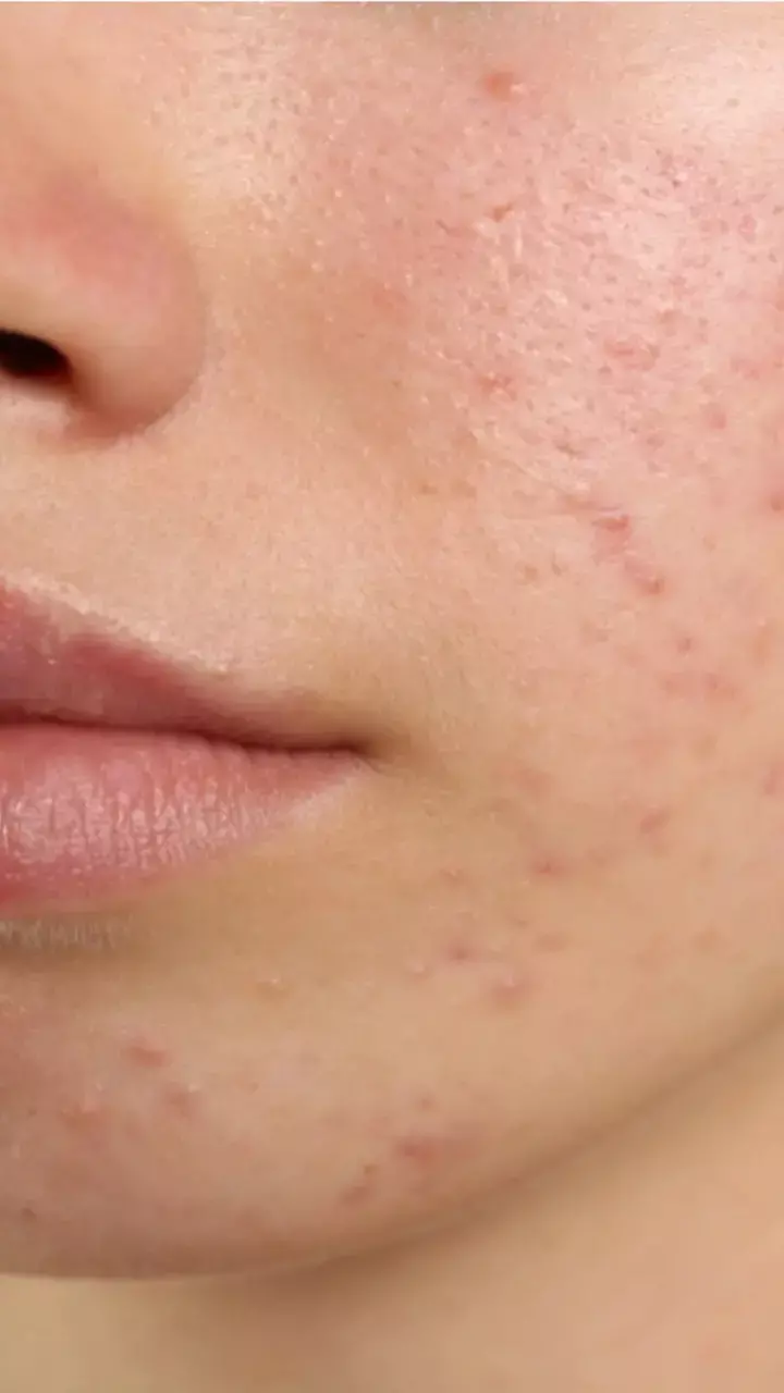 Skin Care Tips: चेहरे से जिद्दी दाग-धब्बे हटाएं बिना खर्च के, ये घरेलू नुस्खे देंगे नेचुरल ग्लो!