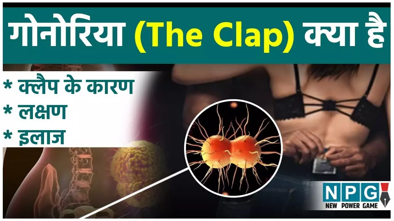 Gonorrhea kya hai: गोनोरिया (The Clap) क्या है: क्लैप के कारण, लक्षण, इलाज और बचाव की पूरी जानकारी हिंदी में