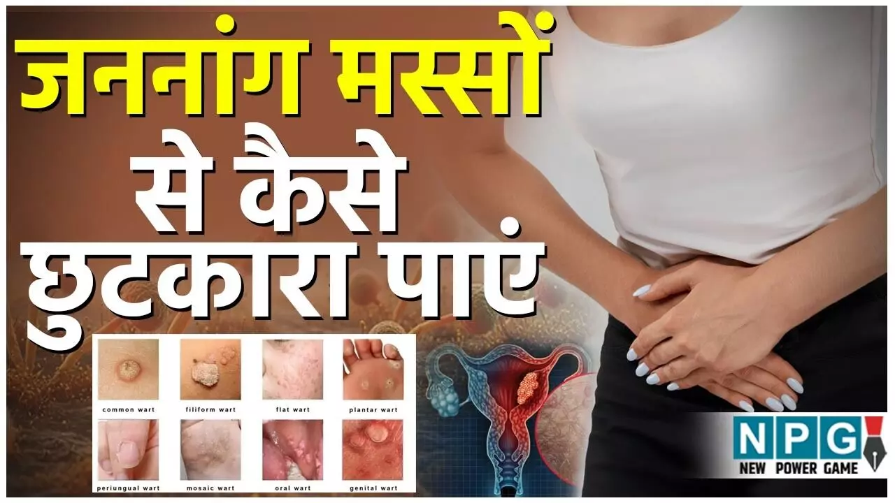 Genital Warts ka ilaj: घरेलू उपाय, इलाज और बचाव की पूरी गाइड हिंदी में