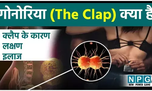 Gonorrhea kya hai: गोनोरिया (The Clap) क्या है: क्लैप के कारण, लक्षण, इलाज और बचाव की पूरी जानकारी हिंदी में