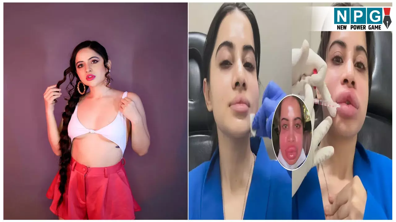 उर्फी जावेद के साथ आखिर ये क्या हुआ? बुरी तरह सूजा होठ और चेहरा, फैंस भी हुए परेशान, देखें वीडियो