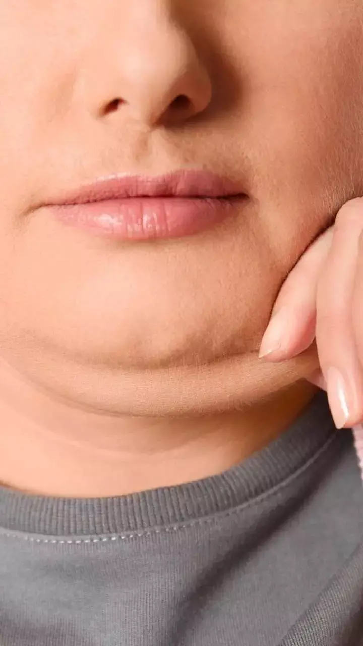 Double Chin Kaise Kam Kare: डबल चिन से छुटकारा पाने के आसान उपाय, अब चेहरा दिखेगा और भी शार्प