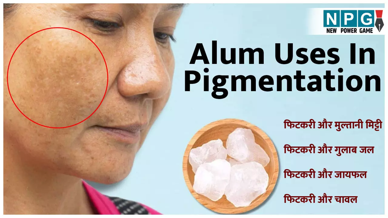 Alum Uses In Pigmentation: झाइयों ने छीन ली चेहरे की सुंदरता? 10 रुपये की फिटकरी के इस्तेमाल से सस्ते में गायब होंगे दाग-धब्बे...