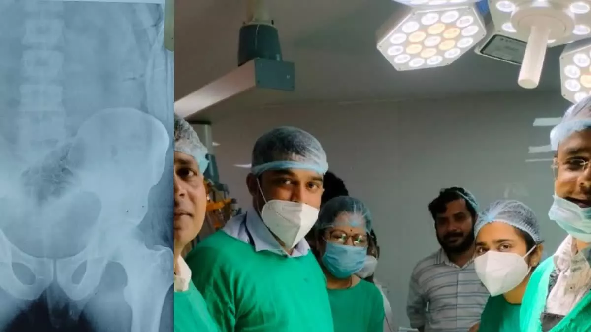 Chhatarpur News : युवक के गुप्तांग में फंसी बॉटल, ना ना... गलत ना समझे दवाई लगते वक्त हुआ हादसा, जान पर बन आई तो पहुंचा हॉस्पिटल