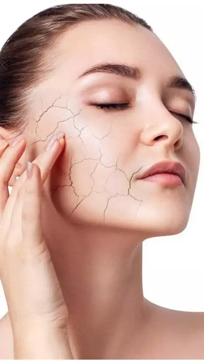 Skin Healthy Tips: स्किन रहती है रूखी-बेजान, तो डाइट में शामिल करें ये चीजें...