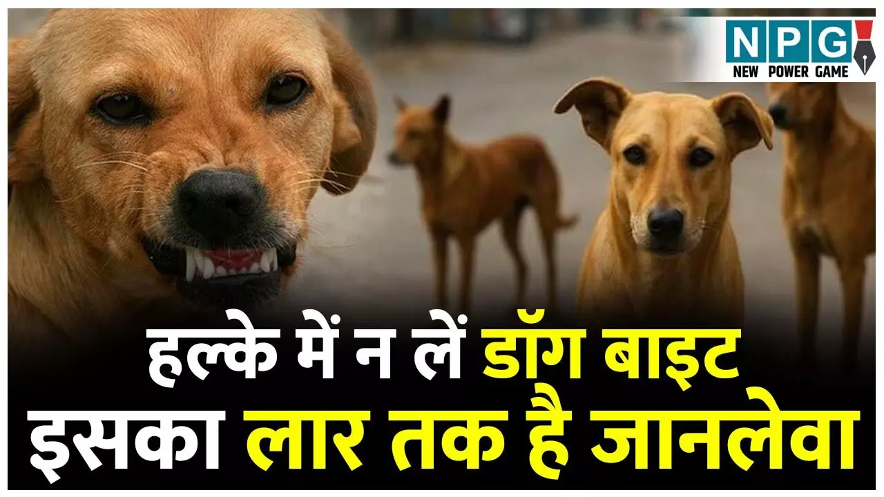 Dog Bites And Rabies: कुत्ते से सावधान...क्योंकि इनके काटने से जा सकती जान