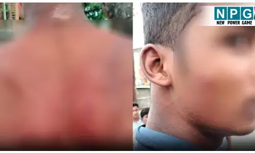 CG News: छत्तीसगढ़ के स्कूल में छात्रों का खूनी संघर्ष: मामूली कहासुनी से बढ़ा विवाद, जमकर बरसाए गए लाठी डंडे, कई घायल...