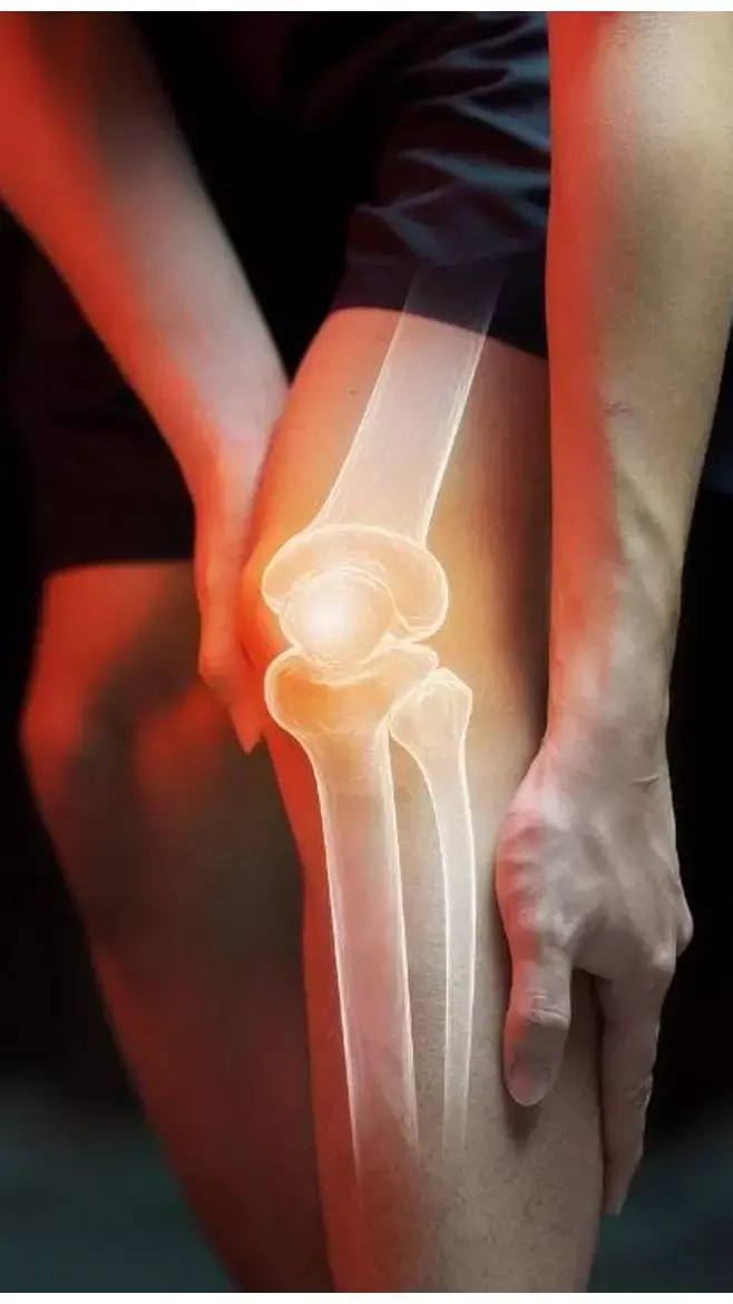 Weaken Bones: खाने की ये चीजें बना रही आपकी हड्डियों को कमजोर, सीमित करें सेवन, नहीं तो...