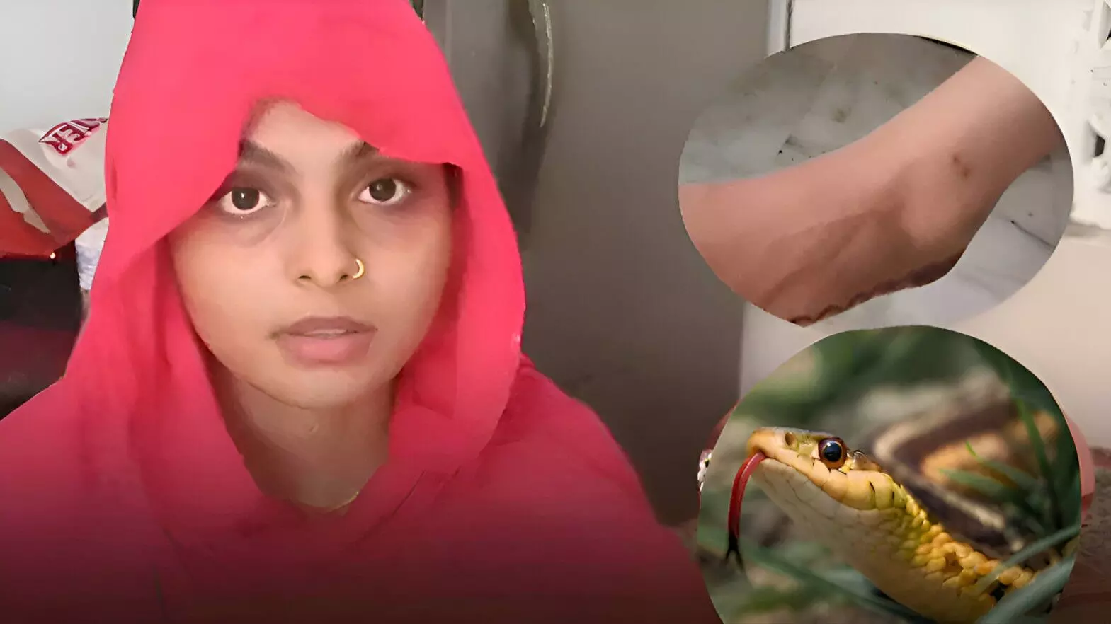 Rajasthan News: 6 महीने में 8 बार सांप ने काटा, फिर भी जिंदा है महिला, डॉक्टर बोले चमत्कार!