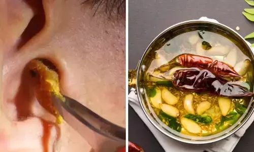 अब घर बैठे बिना दर्द के कान का मैल करें साफ़, नहीं जाना पड़ेगा किसी डॉक्टर के पास, अपनाये ये बेस्ट तरीका