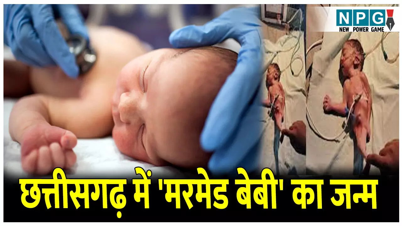 CG Mermaid Baby News: छत्तीसगढ़ में महिला ने दिया मरमेड बेबी को जन्म, डॉक्टरों ने किए ये चौंकाने वाले खुलासे जानकर हो जाएंगे हैरान...