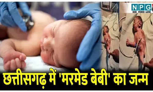 CG Mermaid Baby News: छत्तीसगढ़ में महिला ने दिया मरमेड बेबी को जन्म, डॉक्टरों ने किए ये चौंकाने वाले खुलासे जानकर हो जाएंगे हैरान...