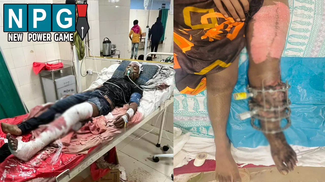 श्री मेडिशाइन हॉस्पिटल के डॉक्टर-स्टाफ ने किया कमाल: युवक के पैर का किया सफल इलाज, मरीज ने डॉक्टरों और स्टाफ को दिया धन्यवाद