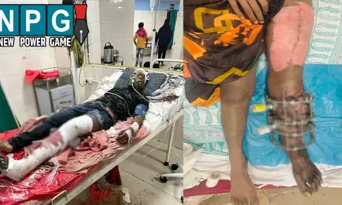 श्री मेडिशाइन हॉस्पिटल के डॉक्टर-स्टाफ ने किया कमाल: युवक के पैर का किया सफल इलाज, मरीज ने डॉक्टरों और स्टाफ को दिया धन्यवाद