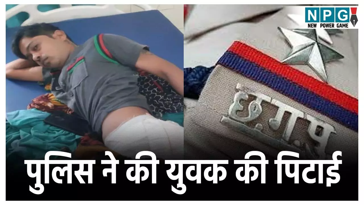 Balodabazar Crime News: पुलिस की बर्बरता! युवक को गालियां दी- कूल्हे पर मारी लात, लगाने पड़े 10 टाँके, TI पर कार्रवाई की मांग