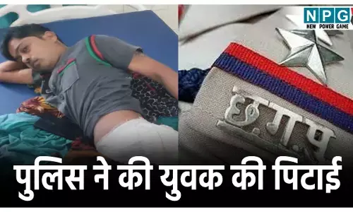 Balodabazar Crime News: पुलिस की बर्बरता! युवक को गालियां दी- कूल्हे पर मारी लात, लगाने पड़े 10 टाँके, TI पर कार्रवाई की मांग