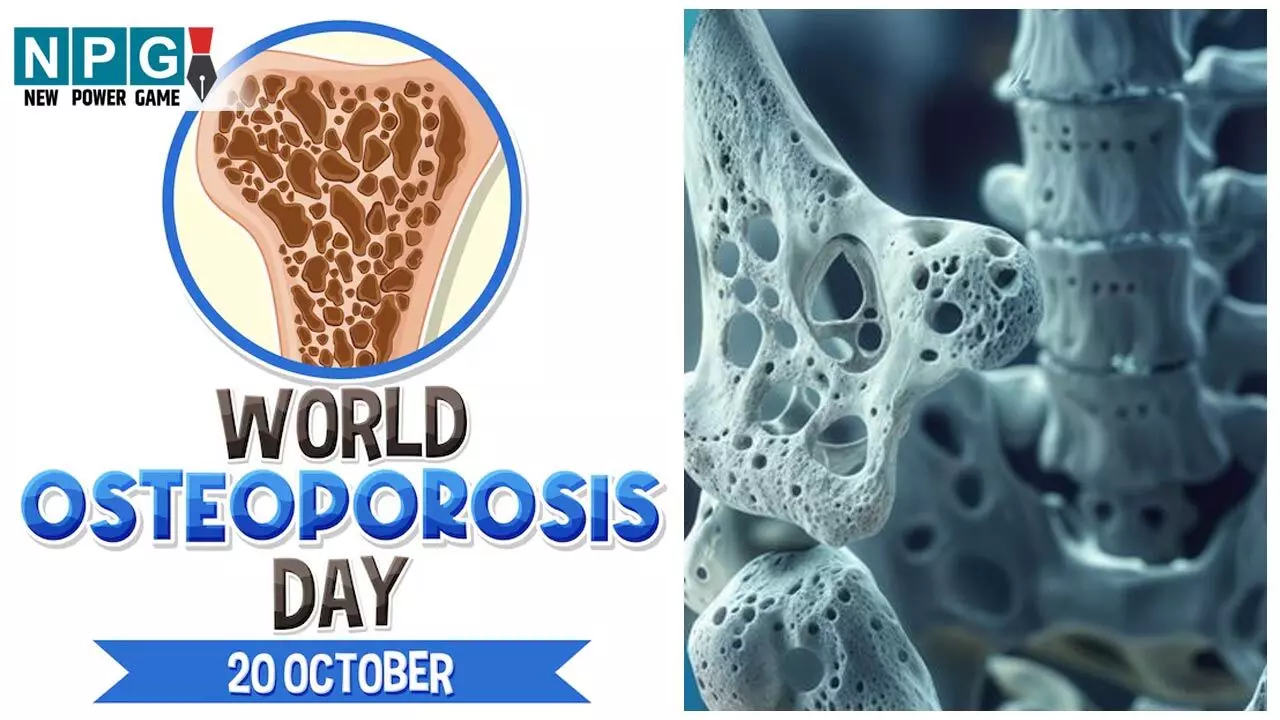 World Osteoporosis Day 2025: हड्डियों को छलनी जैसे छेद देती है ये बीमारी, पहचानने में न करें देर, जाने ऑस्टियोपोरोसिस के लक्षण, कारण और बचाव के उपाय...