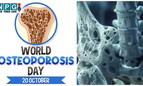 World Osteoporosis Day 2025: हड्डियों को छलनी जैसे छेद देती है ये बीमारी, पहचानने में न करें देर, जाने ऑस्टियोपोरोसिस के लक्षण, कारण और बचाव के उपाय...