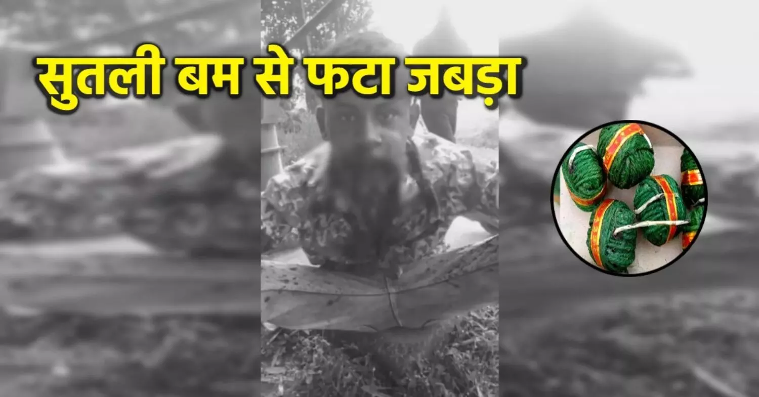 ट्रेंड के चक्कर में यमराज से लिया पंगा! रील बनाते-बनाते मुँह में ही फोड़ा 7 सुतली बम, आठवां मुँह में ही फटा..जबड़े के उड़े चिथड़े