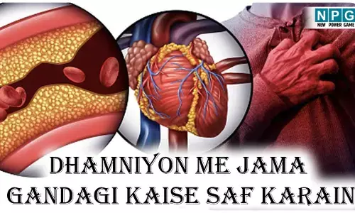Dhamniyon Me Jama Gandagi Kaise Saf Karain: धमनियों में जमा प्लाक हो सकता है जानलेवा, जाने हार्ट अटैक और स्ट्रोक से बचने नेचुरल चीज़ों से अपनी आर्टरीज़ कैसे साफ करें...