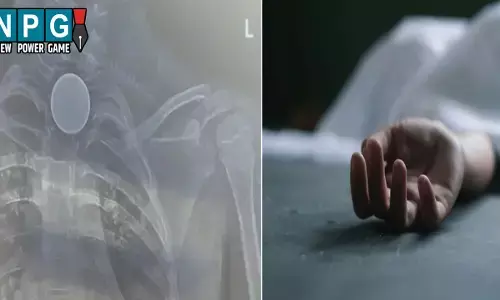 Korba News: मासूम के सीने में फंसा सिक्का: जिला अस्पताल ने कर दिया रेफर, बीच रास्ते में हुई मौत, परिजनों ने लगाया लापरवाही का आरोप