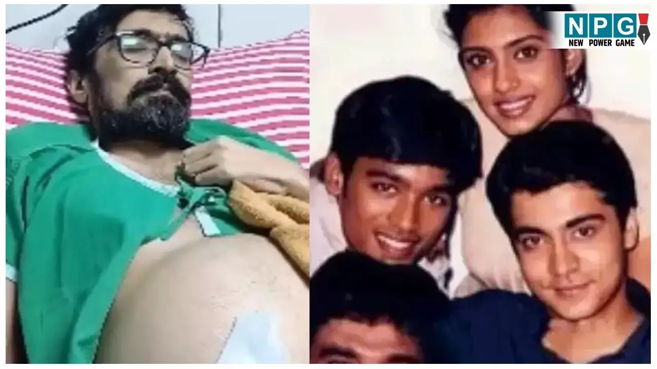 Actor Abhinay Kinger Death: लिवर इंफेक्शन के चलते एक्टर की मौत: 44 साल की उम्र में दुनिया को कहा अलविदा...