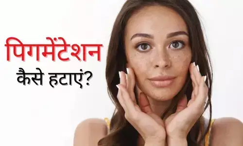 Home Remedies for pigmentation: झाइयों से छुटकारा पाने का घरेलू उपाय: जायफल से कैसे हटाएं झाइयां? जानिए पिगमेंटेशन की होम रेमेडीज