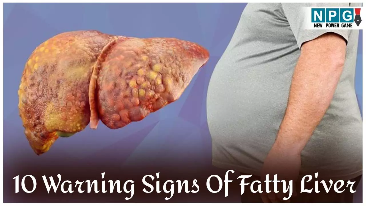 10 Warning Signs Of Fatty Liver: फैटी लिवर के इन 10 संकेतों को न करें नज़रअंदाज, रहें सतर्क