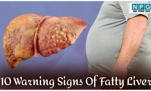 10 Warning Signs Of Fatty Liver: फैटी लिवर के इन 10 संकेतों को न करें नज़रअंदाज, रहें सतर्क