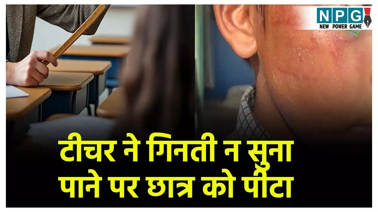 Balrampur Teacher News: स्कूल शिक्षक की शर्मनाक हरकत... गिनती न सुना पाने पर छात्र को बेरहमी से मारा, आंख में उतरा खून- सूज गया गाल