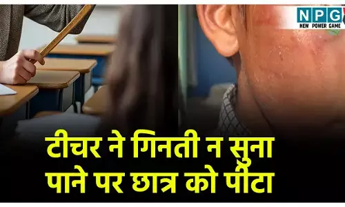 Balrampur Teacher News: स्कूल शिक्षक की शर्मनाक हरकत... गिनती न सुना पाने पर छात्र को बेरहमी से मारा, आंख में उतरा खून- सूज गया गाल