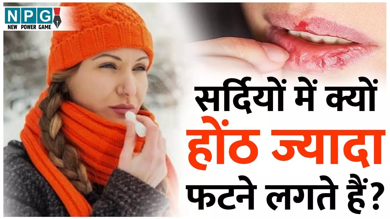 Dry Lips In Winter: सर्दियों में क्यों होंठ ज्यादा फटने लगते हैं? जाने  कारण और बचाव के उपाय