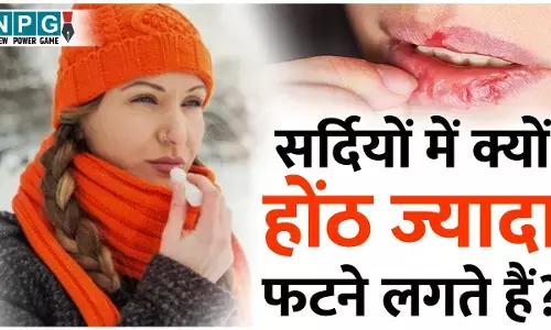 Dry Lips In Winter: सर्दियों में क्यों होंठ ज्यादा फटने लगते हैं? जाने  कारण और बचाव के उपाय