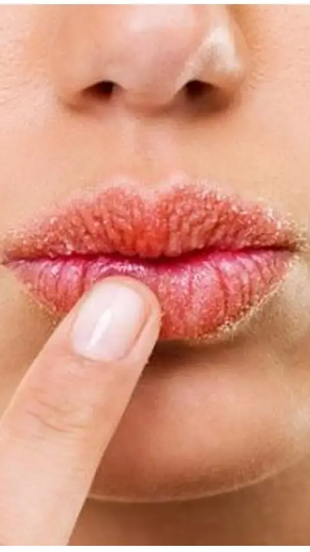 Lip Care In Winter: सर्दी में होंठों की ऐसे करें केयर, रहेंगे साॅफ्ट और पिंक