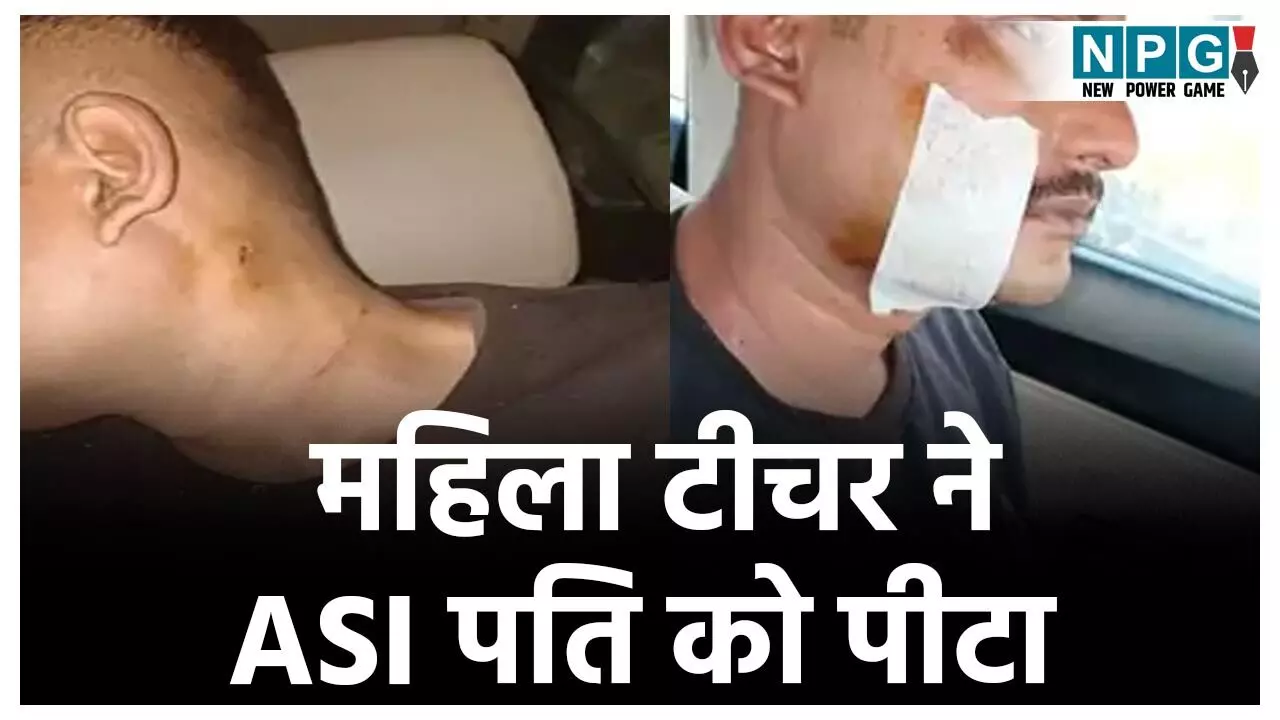 Ambikapur News: नशे में धुत होकर घर पहुंचा ASI पति, तो महिला टीचर ने कर दी बेरहमी से पिटाई, बुरी तरह हुआ घायल Ambikapur News: नशे में धुत होकर घर पहुंचा ASI पति, तो महिला टीचर ने कर दी बेरहमी से पिटाई, बुरी तरह हुआ घायल