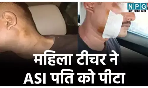 Ambikapur News: नशे में धुत होकर घर पहुंचा ASI पति, तो महिला टीचर ने कर दी बेरहमी से पिटाई, बुरी तरह हुआ घायल