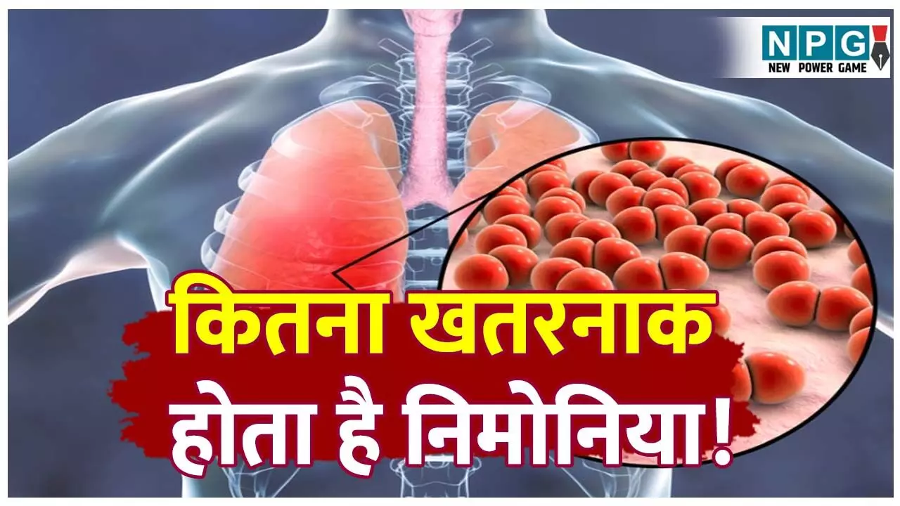 Pneumonia bimari kya hoti hai: एक ऐसी खतरनाक बीमारी जिससे फेफड़ों में हो जाते है फोड़े और फंगस, जानिए निमोनिया के बारे में पूरी डिटेल.... Pneumonia bimari kya hoti hai: एक ऐसी खतरनाक बीमारी जिससे फेफड़ों में हो जाते है फोड़े और फंगस, जानिए निमोनिया के बारे में पूरी डिटेल....