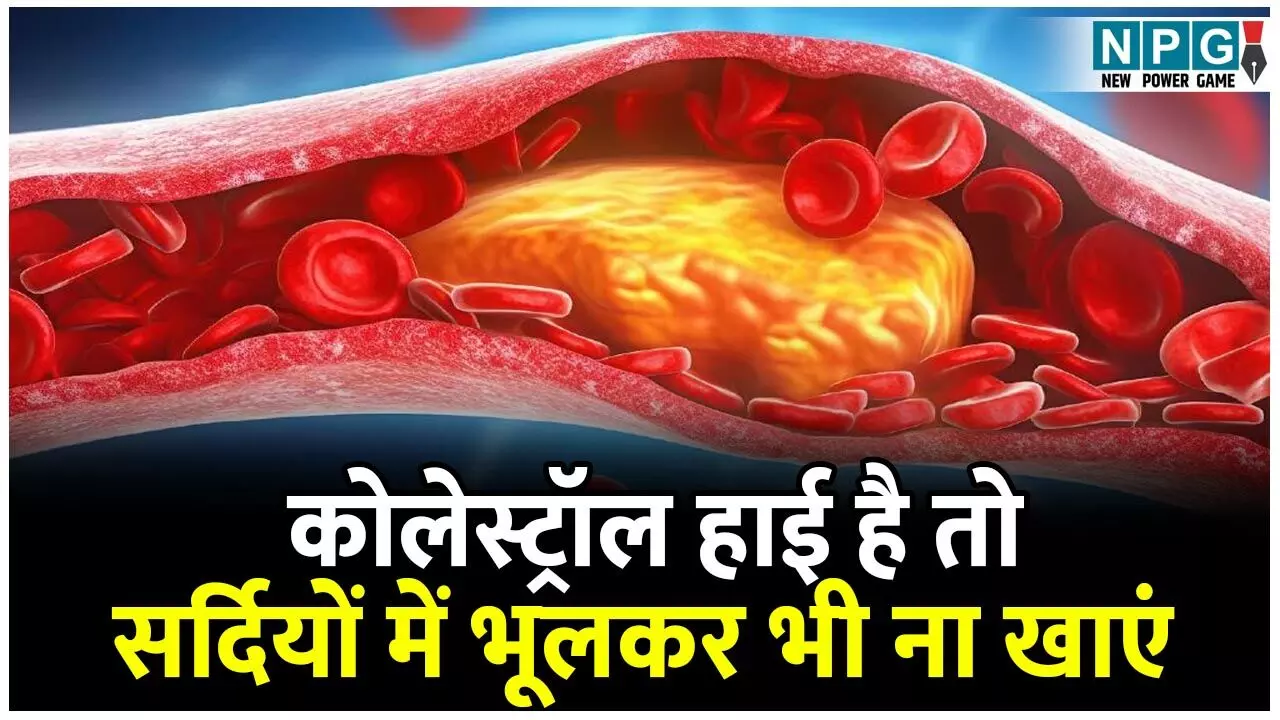 High Cholesterol: हाई रहता है कोलेस्ट्रॉल तो सर्दियों में भूलकर भी ना खाएं ये पांच चीजें High Cholesterol: हाई रहता है कोलेस्ट्रॉल तो सर्दियों में भूलकर भी ना खाएं ये पांच चीजें