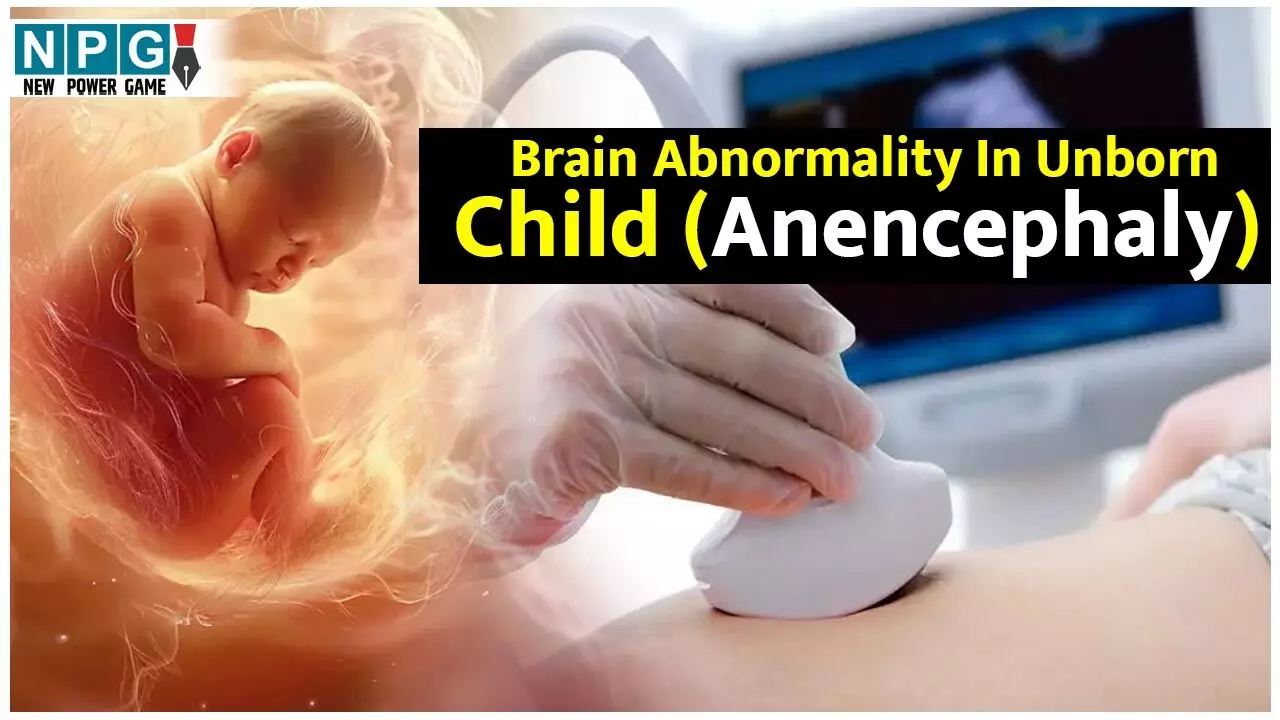 Brain Abnormality In Unborn Child (Anencephaly): माँ में हो ये कमी तो हो सकता है गर्भ में न बने बच्चे का पूरा सिर... जाने कौन सी ये जटिल समस्या और बचाव का क्या है उपाय... Brain Abnormality In Unborn Child (Anencephaly): माँ में हो ये कमी तो हो सकता है गर्भ में न बने बच्चे का पूरा सिर... जाने कौन सी ये जटिल समस्या और बचाव का क्या है उपाय...