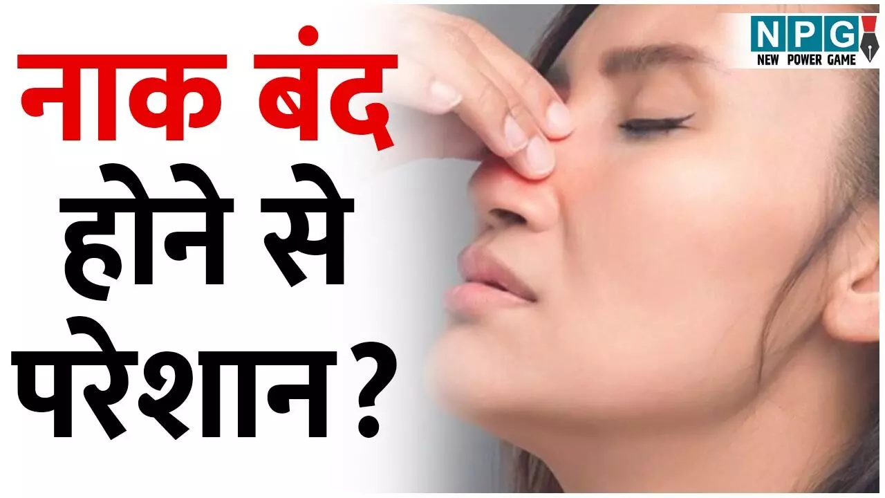 Band Nak Kaise Kholain: नाक बंद होने से परेशान? इन उपायों से 48 घंटे में मिलेगा आराम... Band Nak Kaise Kholain: नाक बंद होने से परेशान? इन उपायों से 48 घंटे में मिलेगा आराम...